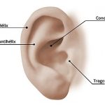 Cirugia de orejas