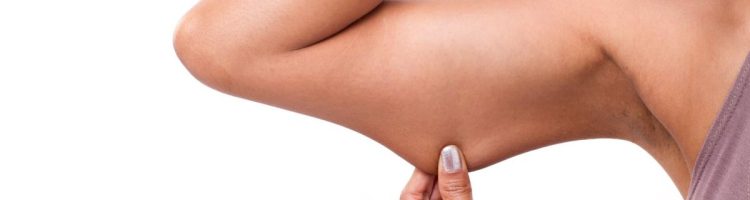 Beneficios del lifting de brazos (braquioplastia)